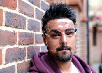 Samir Hussain wearing a face mask - which he keeps on 24 hours a day - as he recovered from burns suffered in an acid attack.  (file pic) See National News story NNACID; Two men have admitted their part in throwing acid in a cinema-goer's face outside a screening of Straight Outta Compton after shouting "you can seen gangsters now". Samir Hussain was left with life-changing injuries from the horrific burns following the attack at a Cineworld.  The 28-year-old still has to wear a face mask 18 months after the attack in Crawley, West Sussex, in August 2015. Michael McPherson, 27, of Tooting Bec, south London, who threw sulphuric acid in Samir's face, previously admitted grievous bodily harm and will be sentenced at a later date. Lee Bates, 26, of Clapham, south west London, who was with McPherson at the time of the attack and punched Samir, admitted common assault and was sentenced today to a two-year conditional discharge at Brighton Magistrates' Court on Monday.